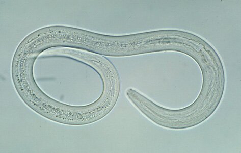 Hookworm_filariform_A
