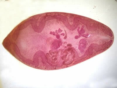 Paragonimus_adult_hematoxylin2
