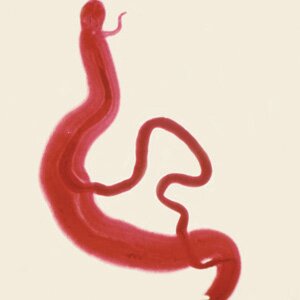 Schistosomiasis (Schistosoma japonicum) | CaliVita | Parasites Schistosomiasis (Schistosoma japonicum) | CaliVita | Parasites
