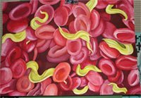 Trypanosoma_gambiense