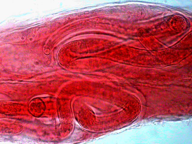 Tspira3